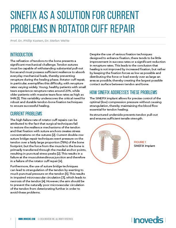 SINEFIX as a Solution for Current 
Problems in Rotator Cuff REPAIR