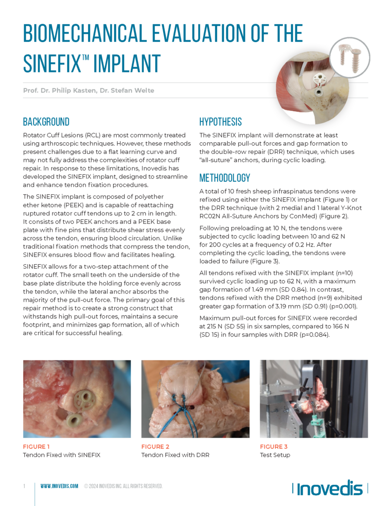 Biomechanical Evaluation of the<br />
SINEFIXTM Implant