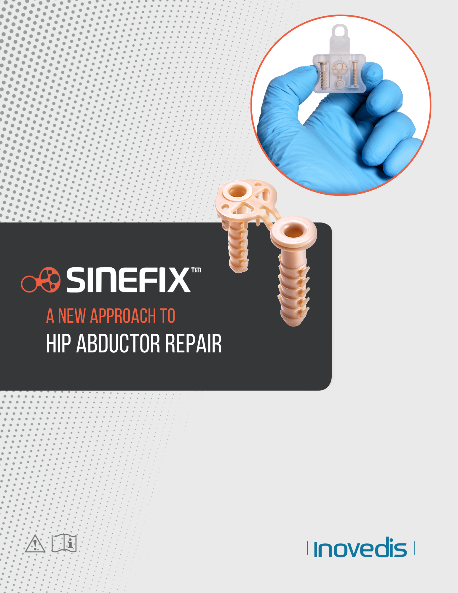 Hip Abductor Repair Brochure Cover Sinefix Hip Abductor Repair Brochure